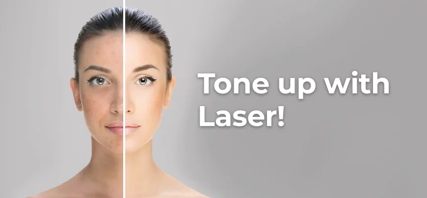Laser Toning Treatment